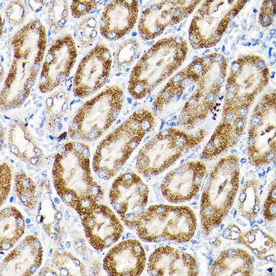 Immunohistochemistry: SCFD1 Antibody [NBP3-38582] - Immunohistochemistry analysis of paraffin-embedded Mouse kidney using SCFD1 Rabbit pAb at dilution of 1:200 (40x lens). High pressure antigen retrieval performed with 0.01M Citrate Bufferr (pH 6.0) prior to IHC staining.