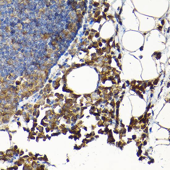 Immunohistochemistry: SCFD1 Antibody [NBP3-38582] - Immunohistochemistry analysis of paraffin-embedded Rat lung using SCFD1 Rabbit pAb at dilution of 1:200 (40x lens). High pressure antigen retrieval performed with 0.01M Citrate Bufferr (pH 6.0) prior to IHC staining.