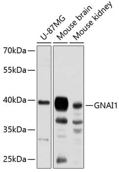 Western Blot: G protein alpha inhibitor 1 Antibody [NBP3-38583] - Western blot analysis of various lysates using G protein alpha inhibitor 1 Rabbit pAb at 1:3000 dilution.Secondary antibody: HRP-conjugated Goat anti-Rabbit IgG (H+L) at 1:10000 dilution.Lysates/proteins: 25ug per lane.Blocking buffer: 3% nonfat dry milk in TBST.Detection: ECL Basic Kit.Exposure time: 90s.