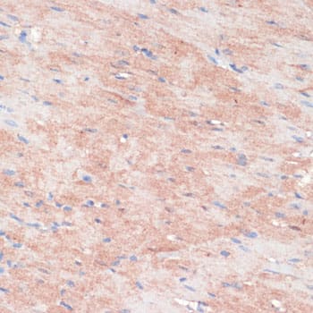 Immunohistochemistry: RPIA Antibody [NBP3-38584] - Immunohistochemistry analysis of paraffin-embedded Rat heart using RPIA Rabbit pAb at dilution of 1:100 (40x lens). Microwave antigen retrieval performed with 0.01M PBS Buffer (pH 7.2) prior to IHC staining.