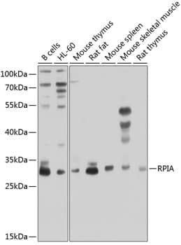 Western Blot: RPIA Antibody [NBP3-38584] - Western blot analysis of various lysates using RPIA Rabbit pAb at 1:1000 dilution.Secondary antibody: HRP-conjugated Goat anti-Rabbit IgG (H+L) at 1:10000 dilution.Lysates/proteins: 25ug per lane.Blocking buffer: 3% nonfat dry milk in TBST.Detection: ECL Enhanced Kit.Exposure time: 30s.