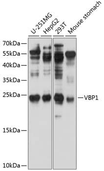 Western Blot: VBP1 Antibody [NBP3-38587] - Western blot analysis of various lysates using VBP1 Rabbit pAb at 1:1000 dilution.Secondary antibody: HRP-conjugated Goat anti-Rabbit IgG (H+L) at 1:10000 dilution.Lysates/proteins: 25ug per lane.Blocking buffer: 3% nonfat dry milk in TBST.Detection: ECL Basic Kit.Exposure time: 1s.