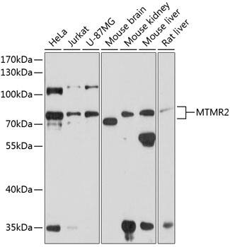 Western Blot: MTMR2 Antibody [NBP3-38588] - Western blot analysis of various lysates using MTMR2 Rabbit pAb at 1:1000 dilution.Secondary antibody: HRP-conjugated Goat anti-Rabbit IgG (H+L) at 1:10000 dilution.Lysates/proteins: 25ug per lane.Blocking buffer: 3% nonfat dry milk in TBST.Detection: ECL Basic Kit.Exposure time: 30s.