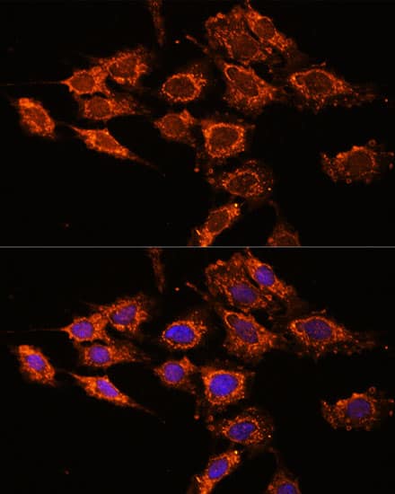 Immunocytochemistry/ Immunofluorescence: PASK Antibody [NBP3-38589] - Immunofluorescence analysis of C6 cells using PASK Rabbit pAb at dilution of 1:100. Secondary antibody: Cy3-conjugated Goat anti-Rabbit IgG (H+L) at 1:500 dilution. Blue: DAPI for nuclear staining.