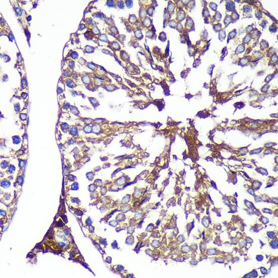 Immunohistochemistry: PASK Antibody [NBP3-38589] - Immunohistochemistry analysis of paraffin-embedded Rat testis using PASK Rabbit pAb at dilution of 1:100 (40x lens). Microwave antigen retrieval performed with 0.01M PBS Buffer (pH 7.2) prior to IHC staining.