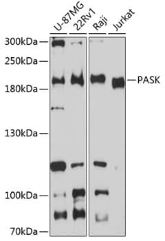 Western Blot: PASK Antibody [NBP3-38589] - Western blot analysis of various lysates using PASK Rabbit pAb at 1:3000 dilution.Secondary antibody: HRP-conjugated Goat anti-Rabbit IgG (H+L) at 1:10000 dilution.Lysates/proteins: 25ug per lane.Blocking buffer: 3% nonfat dry milk in TBST.Detection: ECL Basic Kit.Exposure time: 90s.