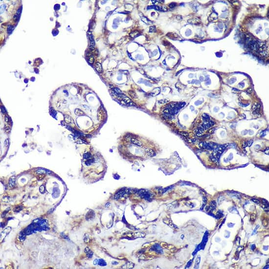 Immunohistochemistry: PASK Antibody [NBP3-38589] - Immunohistochemistry analysis of paraffin-embedded Human placenta using PASK Rabbit pAb at dilution of 1:100 (40x lens). Microwave antigen retrieval performed with 0.01M PBS Buffer (pH 7.2) prior to IHC staining.