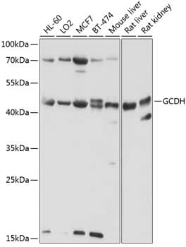 Western Blot: GCDH Antibody [NBP3-38591] - Western blot analysis of various lysates using GCDH Rabbit pAb at 1:1000 dilution.Secondary antibody: HRP-conjugated Goat anti-Rabbit IgG (H+L) at 1:10000 dilution.Lysates/proteins: 25ug per lane.Blocking buffer: 3% nonfat dry milk in TBST.Detection: ECL Basic Kit.Exposure time: 30s.