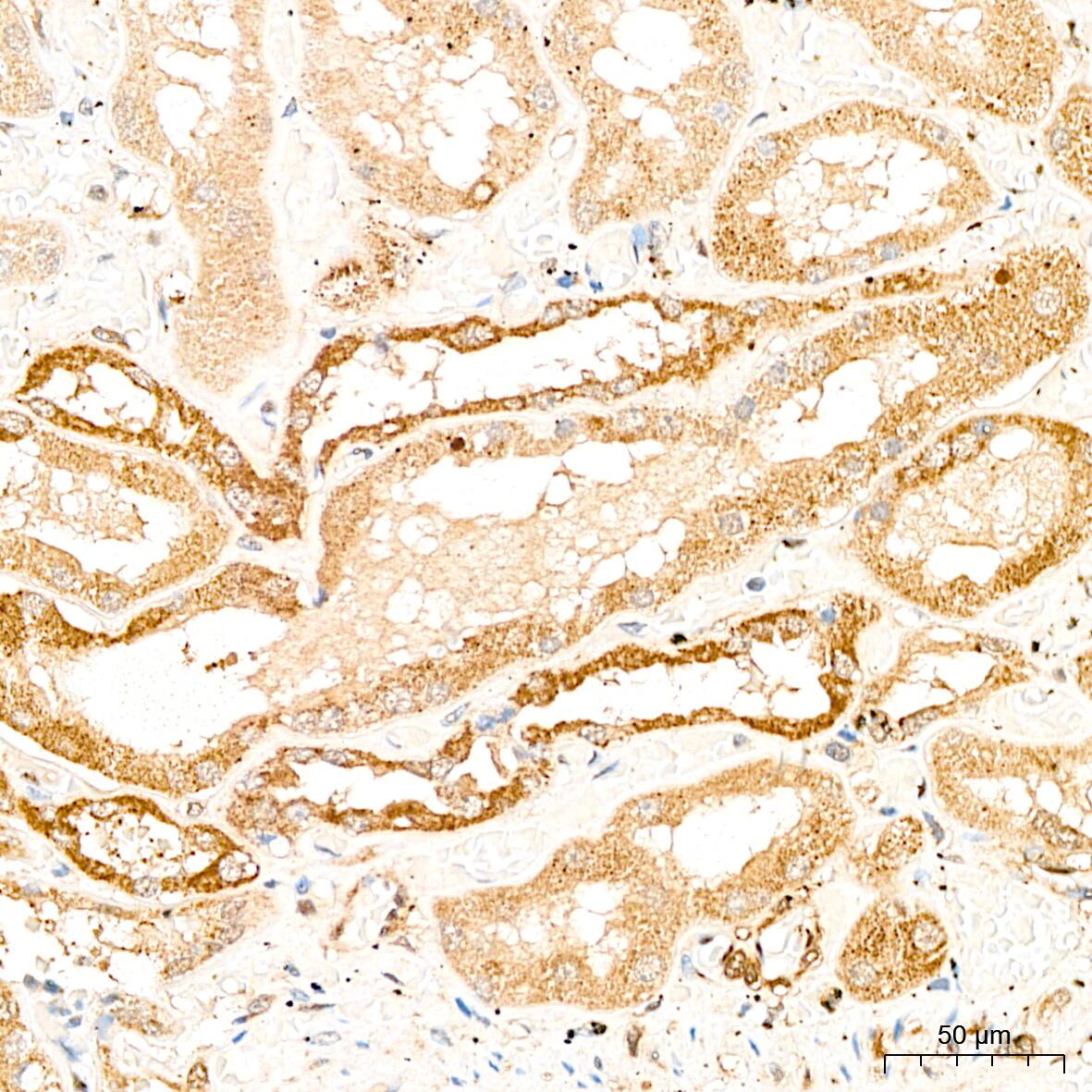 Immunohistochemistry: GCDH Antibody [NBP3-38591] - Immunohistochemistry analysis of paraffin-embedded Human kidney tissue using GCDH Rabbit pAb at a dilution of 1:200 (40x lens). High pressure antigen retrieval performed with 0.01M Citrate Bufferr (pH 6.0) prior to IHC staining.