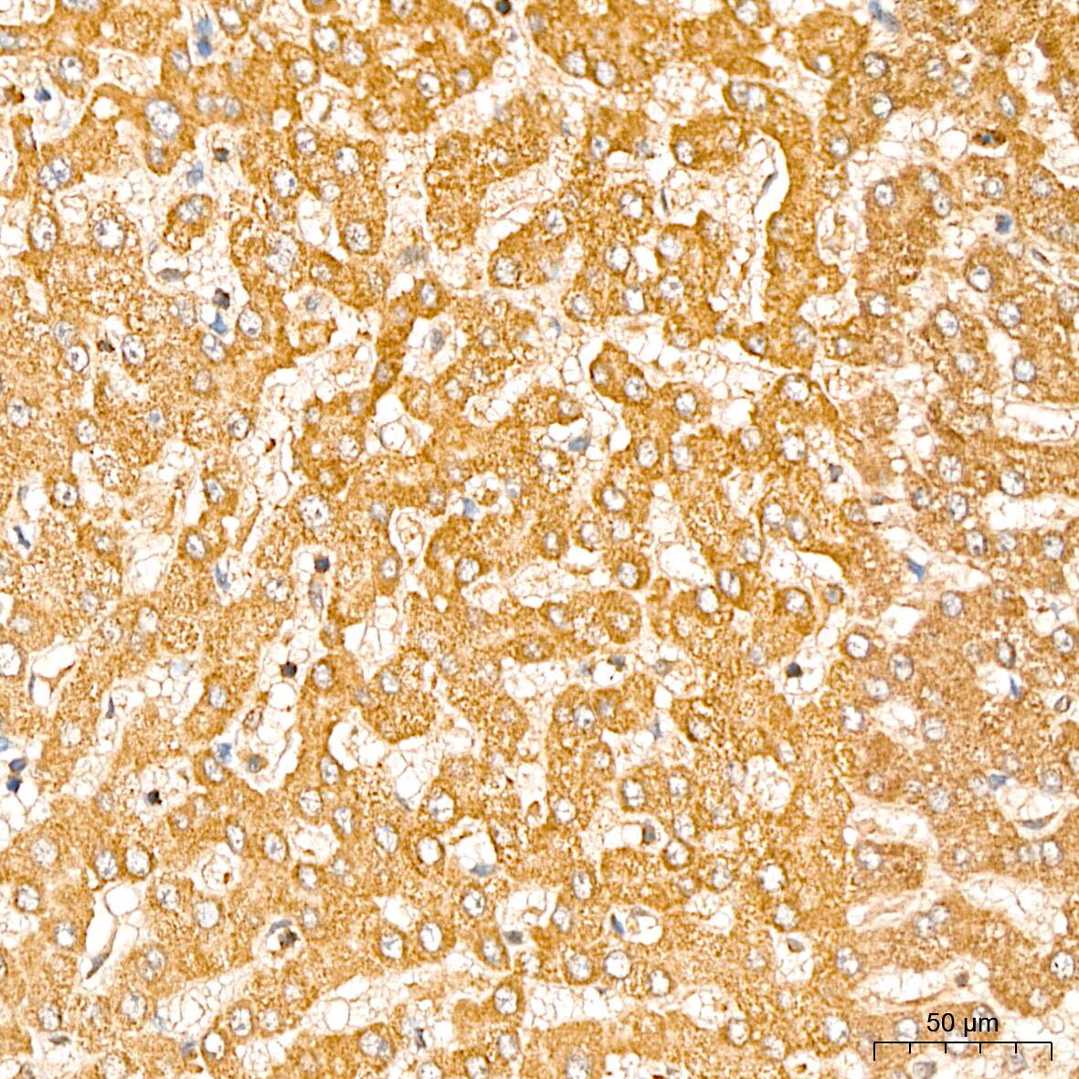 Immunohistochemistry: GCDH Antibody [NBP3-38591] - Immunohistochemistry analysis of paraffin-embedded Human liver tissue using GCDH Rabbit pAb at a dilution of 1:200 (40x lens). High pressure antigen retrieval performed with 0.01M Citrate Bufferr (pH 6.0) prior to IHC staining.