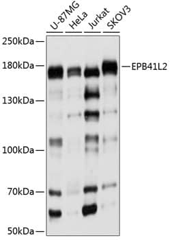 Western Blot: EPB4IL2 Antibody [NBP3-38592] - Western blot analysis of various lysates using EPB4IL2 Rabbit pAb at 1:1000 dilution.Secondary antibody: HRP-conjugated Goat anti-Rabbit IgG (H+L) at 1:10000 dilution.Lysates/proteins: 25ug per lane.Blocking buffer: 3% nonfat dry milk in TBST.Detection: ECL Basic Kit.Exposure time: 5s.