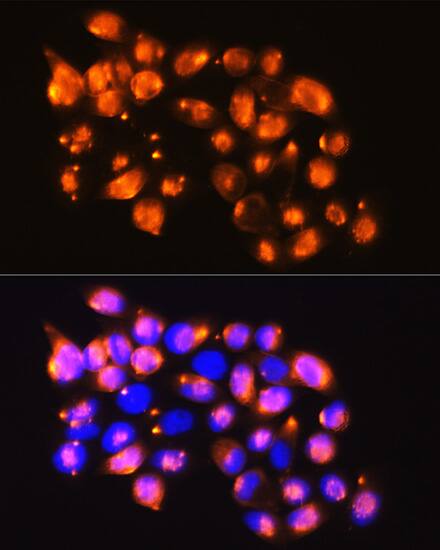 Immunocytochemistry/ Immunofluorescence: EPB4IL2 Antibody [NBP3-38592] - Immunofluorescence analysis of HeLa cells using EPB4IL2 Rabbit pAb at dilution of 1:100. Blue: DAPI for nuclear staining.