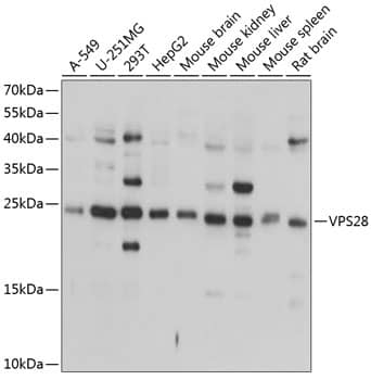 Western Blot: VPS28 Antibody [NBP3-38593] - Western blot analysis of various lysates using VPS28 Rabbit pAb at 1:1000 dilution.Secondary antibody: HRP-conjugated Goat anti-Rabbit IgG (H+L) at 1:10000 dilution.Lysates/proteins: 25ug per lane.Blocking buffer: 3% nonfat dry milk in TBST.Detection: ECL Basic Kit.Exposure time: 1s.