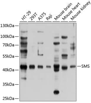 Western Blot: Spermine synthase Antibody [NBP3-38595] - Western blot analysis of various lysates using Spermine synthase Rabbit pAb at 1:1000 dilution.Secondary antibody: HRP-conjugated Goat anti-Rabbit IgG (H+L) at 1:10000 dilution.Lysates/proteins: 25ug per lane.Blocking buffer: 3% nonfat dry milk in TBST.Detection: ECL Basic Kit.Exposure time: 5s.