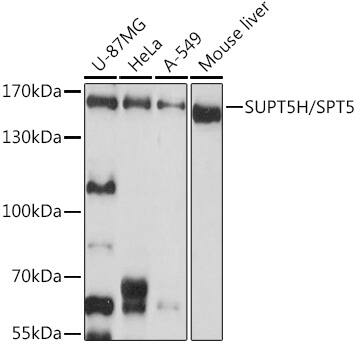 Western Blot: SUPT5H Antibody [NBP3-38598] - Western blot analysis of various lysates using SUPT5H Rabbit pAb at 1:1000 dilution.Secondary antibody: HRP-conjugated Goat anti-Rabbit IgG (H+L) at 1:10000 dilution.Lysates/proteins: 25ug per lane.Blocking buffer: 3% nonfat dry milk in TBST.Detection: ECL Basic Kit.Exposure time: 10s.