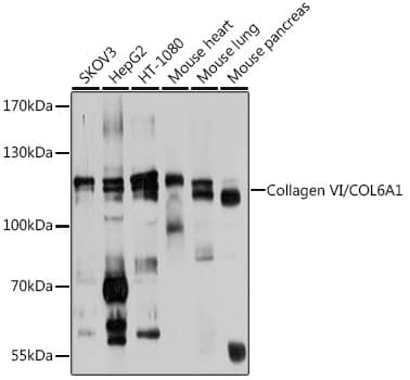 Western Blot: Collagen VI alpha 1 Antibody [NBP3-38600] - Western blot analysis of various lysates using Collagen VI alpha 1 Rabbit pAb at 1:1000 dilution.Secondary antibody: HRP-conjugated Goat anti-Rabbit IgG (H+L) at 1:10000 dilution.Lysates/proteins: 25ug per lane.Blocking buffer: 3% nonfat dry milk in TBST.Detection: ECL Basic Kit.Exposure time: 1s.