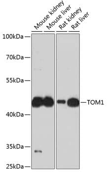 Western Blot: TOM1 Antibody [NBP3-38601] - Western blot analysis of various lysates using TOM1 Rabbit pAb at 1:3000 dilution.Secondary antibody: HRP-conjugated Goat anti-Rabbit IgG (H+L) at 1:10000 dilution.Lysates/proteins: 25ug per lane.Blocking buffer: 3% nonfat dry milk in TBST.Detection: ECL Basic Kit.Exposure time: 90s.