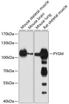 Western Blot: Glycogen phosphorylase, muscle form Antibody [NBP3-38607] - Western blot analysis of various lysates using Glycogen phosphorylase, muscle form Rabbit pAb at 1:1000 dilution.Secondary antibody: HRP-conjugated Goat anti-Rabbit IgG (H+L) at 1:10000 dilution.Lysates/proteins: 25ug per lane.Blocking buffer: 3% nonfat dry milk in TBST.Detection: ECL Basic Kit.Exposure time: 90s.