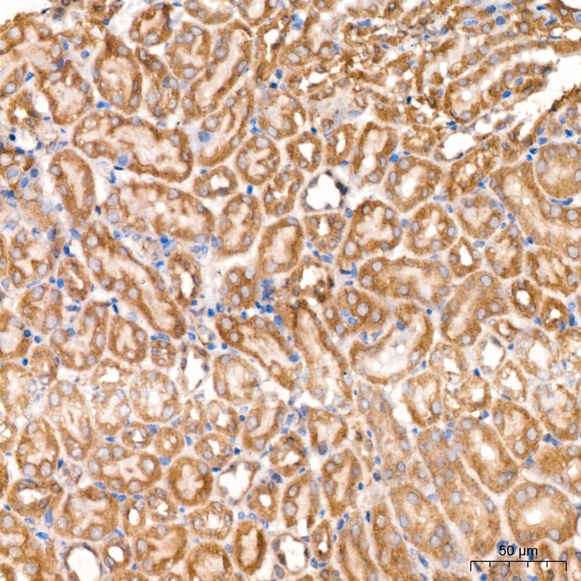 Immunohistochemistry: PCCA Antibody [NBP3-38609] - Immunohistochemistry analysis of paraffin-embedded Mouse kidney tissue using PCCA Rabbit pAb at a dilution of 1:100 (40x lens). High pressure antigen retrieval was performed with 0.01 M citrate buffer (pH 6.0) prior to IHC staining.