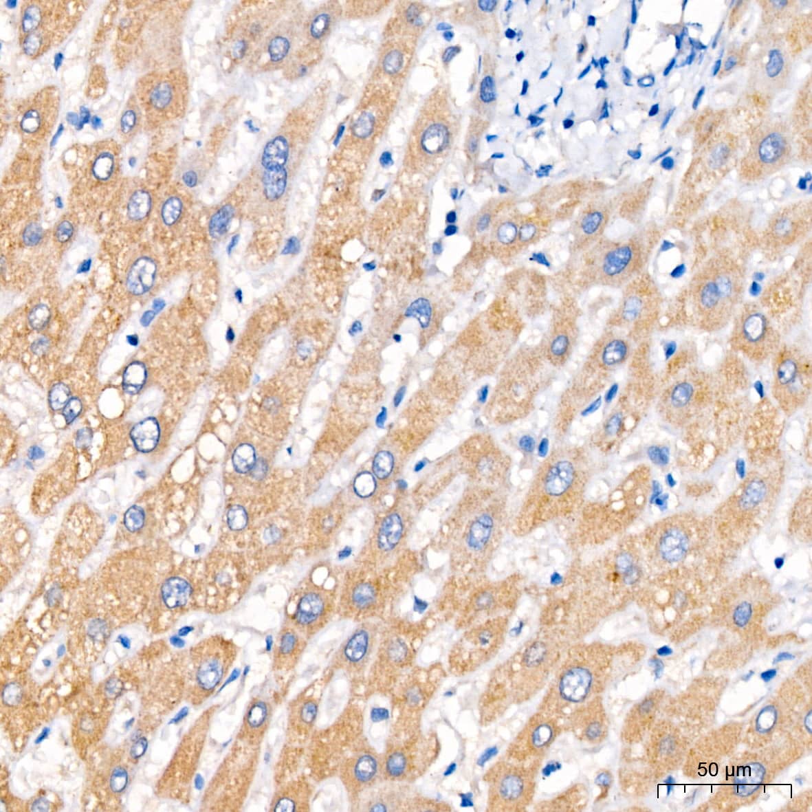 Immunohistochemistry: PCCA Antibody [NBP3-38609] - Immunohistochemistry analysis of paraffin-embedded Human liver tissue using PCCA Rabbit pAb at a dilution of 1:100 (40x lens). High pressure antigen retrieval was performed with 0.01 M citrate buffer (pH 6.0) prior to IHC staining.