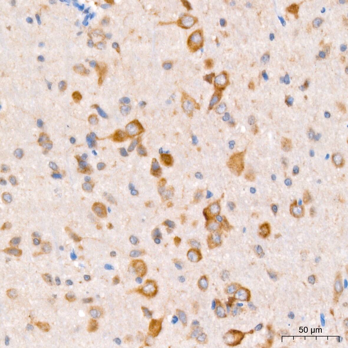 Immunohistochemistry: PCCA Antibody [NBP3-38609] - Immunohistochemistry analysis of paraffin-embedded Rat brain tissue using PCCA Rabbit pAb at a dilution of 1:100 (40x lens). High pressure antigen retrieval was performed with 0.01 M citrate buffer (pH 6.0) prior to IHC staining.