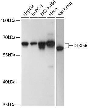 Western Blot: DDX56 Antibody [NBP3-38610] - Western blot analysis of various lysates using DDX56 Rabbit pAb at 1:3000 dilution.Secondary antibody: HRP-conjugated Goat anti-Rabbit IgG (H+L) at 1:10000 dilution.Lysates/proteins: 25ug per lane.Blocking buffer: 3% nonfat dry milk in TBST.Detection: ECL Basic Kit.Exposure time: 1s.