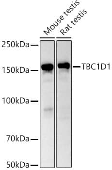 Western Blot: TBC1D1 Antibody [NBP3-38611] - Western blot analysis of various lysates using TBC1D1 Rabbit pAb at 1:1000 dilution.Secondary antibody: HRP-conjugated Goat anti-Rabbit IgG (H+L) at 1:10000 dilution.Lysates/proteins: 25ug per lane.Blocking buffer: 3% nonfat dry milk in TBST.Detection: ECL Basic Kit.Exposure time: 90s.