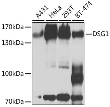 Western Blot: Desmoglein-1 Antibody [NBP3-38618] - Western blot analysis of various lysates using Desmoglein-1 Rabbit pAb at 1:1000 dilution.Secondary antibody: HRP-conjugated Goat anti-Rabbit IgG (H+L) at 1:10000 dilution.Lysates/proteins: 25ug per lane.Blocking buffer: 3% nonfat dry milk in TBST.Detection: ECL Basic Kit.Exposure time: 30s.