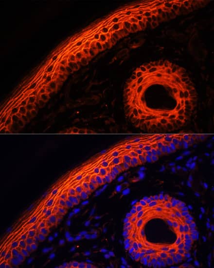 Immunocytochemistry/ Immunofluorescence: Desmoglein-1 Antibody [NBP3-38618] - Immunofluorescence analysis of paraffin-embedded rat skin using Desmoglein-1 Rabbit pAb at dilution of 1:100. Secondary antibody: Cy3-conjugated Goat anti-Rabbit IgG (H+L) at 1:500 dilution. Blue: DAPI for nuclear staining.