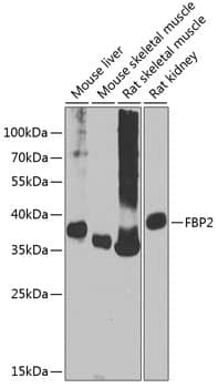 Western Blot: FBP2 Antibody [NBP3-38621] - Western blot analysis of various lysates using FBP2 Rabbit pAb at 1:1000 dilution.Secondary antibody: HRP-conjugated Goat anti-Rabbit IgG (H+L) at 1:10000 dilution.Lysates/proteins: 25ug per lane.Blocking buffer: 3% nonfat dry milk in TBST.Detection: ECL Basic Kit.Exposure time: 90s.