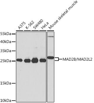 Western Blot: MAD2L2 Antibody [NBP3-38622] - Western blot analysis of various lysates using MAD2L2 Rabbit pAb at 1:1000 dilution.Secondary antibody: HRP-conjugated Goat anti-Rabbit IgG (H+L) at 1:10000 dilution.Lysates/proteins: 25ug per lane.Blocking buffer: 3% nonfat dry milk in TBST.Detection: ECL Basic Kit.Exposure time: 5s.