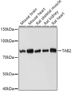 Western Blot: TAB2 Antibody [NBP3-38625] - Western blot analysis of various lysates using TAB2 Rabbit pAb at 1:1000 dilution.Secondary antibody: HRP-conjugated Goat anti-Rabbit IgG (H+L) at 1:10000 dilution.Lysates/proteins: 25ug per lane.Blocking buffer: 3% nonfat dry milk in TBST.Detection: ECL Basic Kit.Exposure time: 1s.