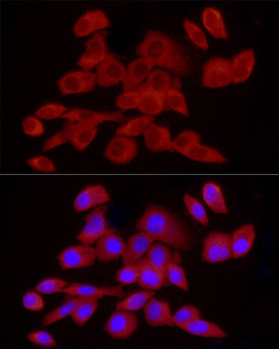 Immunocytochemistry/ Immunofluorescence: CaMKK2 Antibody [NBP3-38627] - Immunofluorescence analysis of PC-3 cells using CaMKK2 Rabbit pAb at dilution of 1:25 (40x lens). Secondary antibody: Cy3-conjugated Goat anti-Rabbit IgG (H+L) at 1:500 dilution. Blue: DAPI for nuclear staining.