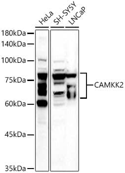Western Blot: CaMKK2 Antibody [NBP3-38627] - Western blot analysis of various lysates using CaMKK2 Rabbit pAb at 1:500 dilution.Secondary antibody: HRP-conjugated Goat anti-Rabbit IgG (H+L) at 1:10000 dilution.Lysates/proteins: 25ug per lane.Blocking buffer: 3% nonfat dry milk in TBST.Detection: ECL Basic Kit.Exposure time: 180s.