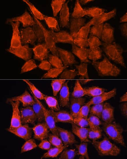 Immunocytochemistry/ Immunofluorescence: Aminomethyltransferase Antibody [NBP3-38628] - Immunofluorescence analysis of HeLa cells using Aminomethyltransferase Rabbit pAb at dilution of 1:100. Secondary antibody: Cy3-conjugated Goat anti-Rabbit IgG (H+L) at 1:500 dilution. Blue: DAPI for nuclear staining.