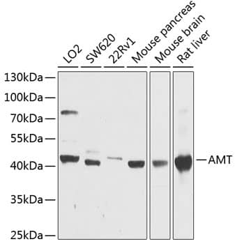 Western Blot: Aminomethyltransferase Antibody [NBP3-38628] - Western blot analysis of various lysates using Aminomethyltransferase Rabbit pAb at 1:1000 dilution.Secondary antibody: HRP-conjugated Goat anti-Rabbit IgG (H+L) at 1:10000 dilution.Lysates/proteins: 25ug per lane.Blocking buffer: 3% nonfat dry milk in TBST.Detection: ECL Basic Kit.Exposure time: 90s.