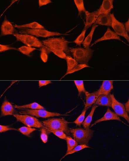 Immunocytochemistry/ Immunofluorescence: Aminomethyltransferase Antibody [NBP3-38628] - Immunofluorescence analysis of NIH/3T3 cells using Aminomethyltransferase Rabbit pAb at dilution of 1:100. Secondary antibody: Cy3-conjugated Goat anti-Rabbit IgG (H+L) at 1:500 dilution. Blue: DAPI for nuclear staining.