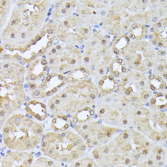 Immunohistochemistry Proteasome 20S beta 3 Antibody