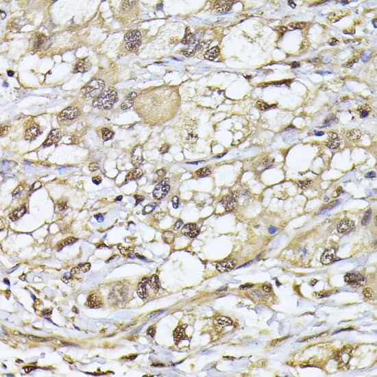 Immunohistochemistry Proteasome 20S beta 3 Antibody