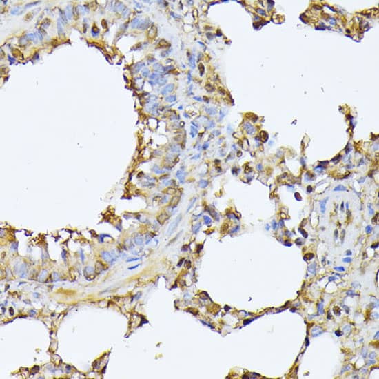 Immunohistochemistry: Proteasome 20S beta 3 Antibody [NBP3-38629] - Immunohistochemistry analysis of paraffin-embedded Rat lung using Proteasome 20S beta 3 Rabbit pAb at dilution of 1:100 (40x lens). Microwave antigen retrieval performed with 0.01M PBS Buffer (pH 7.2) prior to IHC staining.