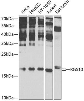 Western Blot: RGS10 Antibody [NBP3-38630] - Western blot analysis of various lysates using RGS10 Rabbit pAb at 1:1000 dilution.Secondary antibody: HRP-conjugated Goat anti-Rabbit IgG (H+L) at 1:10000 dilution.Lysates/proteins: 25ug per lane.Blocking buffer: 3% nonfat dry milk in TBST.Detection: ECL Enhanced Kit.Exposure time: 60s.