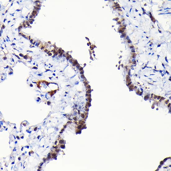 Immunohistochemistry RGS14 Antibody