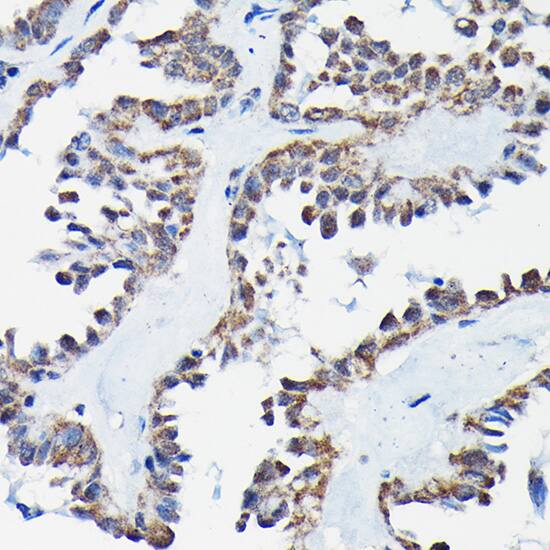 Immunohistochemistry RGS14 Antibody