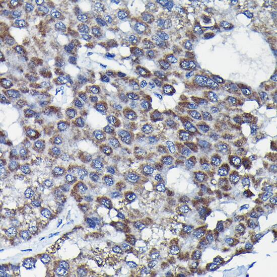 Immunohistochemistry RGS14 Antibody