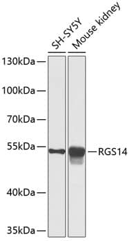 Western Blot: RGS14 Antibody [NBP3-38632] - Western blot analysis of various lysates using RGS14 Rabbit pAb at 1:1000 dilution.Secondary antibody: HRP-conjugated Goat anti-Rabbit IgG (H+L) at 1:10000 dilution.Lysates/proteins: 25ug per lane.Blocking buffer: 3% nonfat dry milk in TBST.Detection: ECL Basic Kit.Exposure time: 60s.