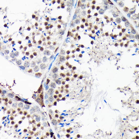 Immunohistochemistry: RGS14 Antibody [NBP3-38632] - Immunohistochemistry analysis of paraffin-embedded Mouse testis using RGS14 Rabbit pAb at dilution of 1:100 (40x lens). High pressure antigen retrieval performed with 0.01M Citrate Bufferr (pH 6.0) prior to IHC staining.