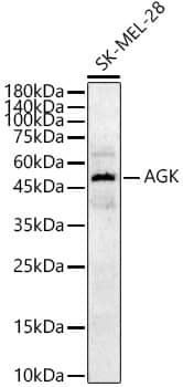 Western Blot: Acylglycerol Kinase Antibody [NBP3-38634] - Western blot analysis of lysates from SK-MEL-28 cells, using Acylglycerol Kinase Rabbit pAb at 1:1000 dilution.Secondary antibody: HRP-conjugated Goat anti-Rabbit IgG (H+L) at 1:10000 dilution.Lysates/proteins: 25ug per lane.Blocking buffer: 3% nonfat dry milk in TBST.Detection: ECL Basic Kit.Exposure time: 30s.