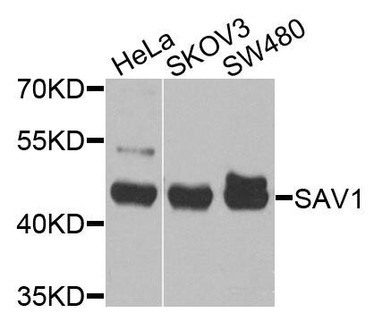 Western Blot: SAV1 Antibody [NBP3-38635] - Western blot analysis of various lysates using SAV1 Rabbit pAb at 1:1000 dilution.Secondary antibody: HRP-conjugated Goat anti-Rabbit IgG (H+L) at 1:10000 dilution.Lysates/proteins: 25ug per lane.Blocking buffer: 3% nonfat dry milk in TBST.Detection: ECL Basic Kit.Exposure time: 30s.