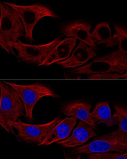 Immunocytochemistry/ Immunofluorescence: alpha Tubulin 4a Antibody [NBP3-38636] - Confocal immunofluorescence analysis of U2OS cells using alpha Tubulin 4a Rabbit pAb at dilution of 1:100 (60x lens). Blue: DAPI for nuclear staining.