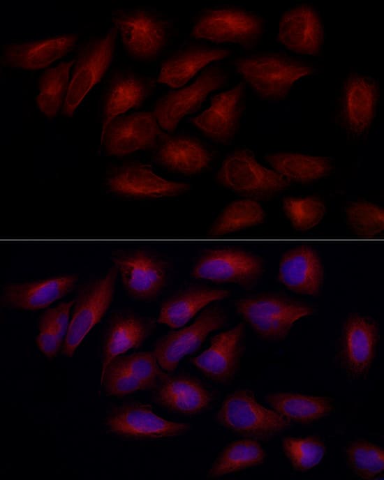 Immunocytochemistry/ Immunofluorescence: alpha Tubulin 4a Antibody [NBP3-38636] - Immunofluorescence analysis of U2OS cells using alpha Tubulin 4a Rabbit pAb at dilution of 1:100 (40x lens). Secondary antibody: Cy3-conjugated Goat anti-Rabbit IgG (H+L) at 1:500 dilution. Blue: DAPI for nuclear staining.